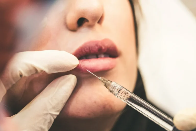 Filler Procedure Claims Life of Estée Lauder Executive - Featured image