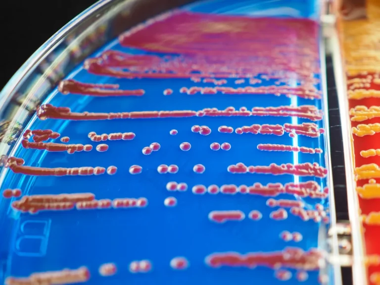 Housemates Share 26% of Oral Microbes - Featured image