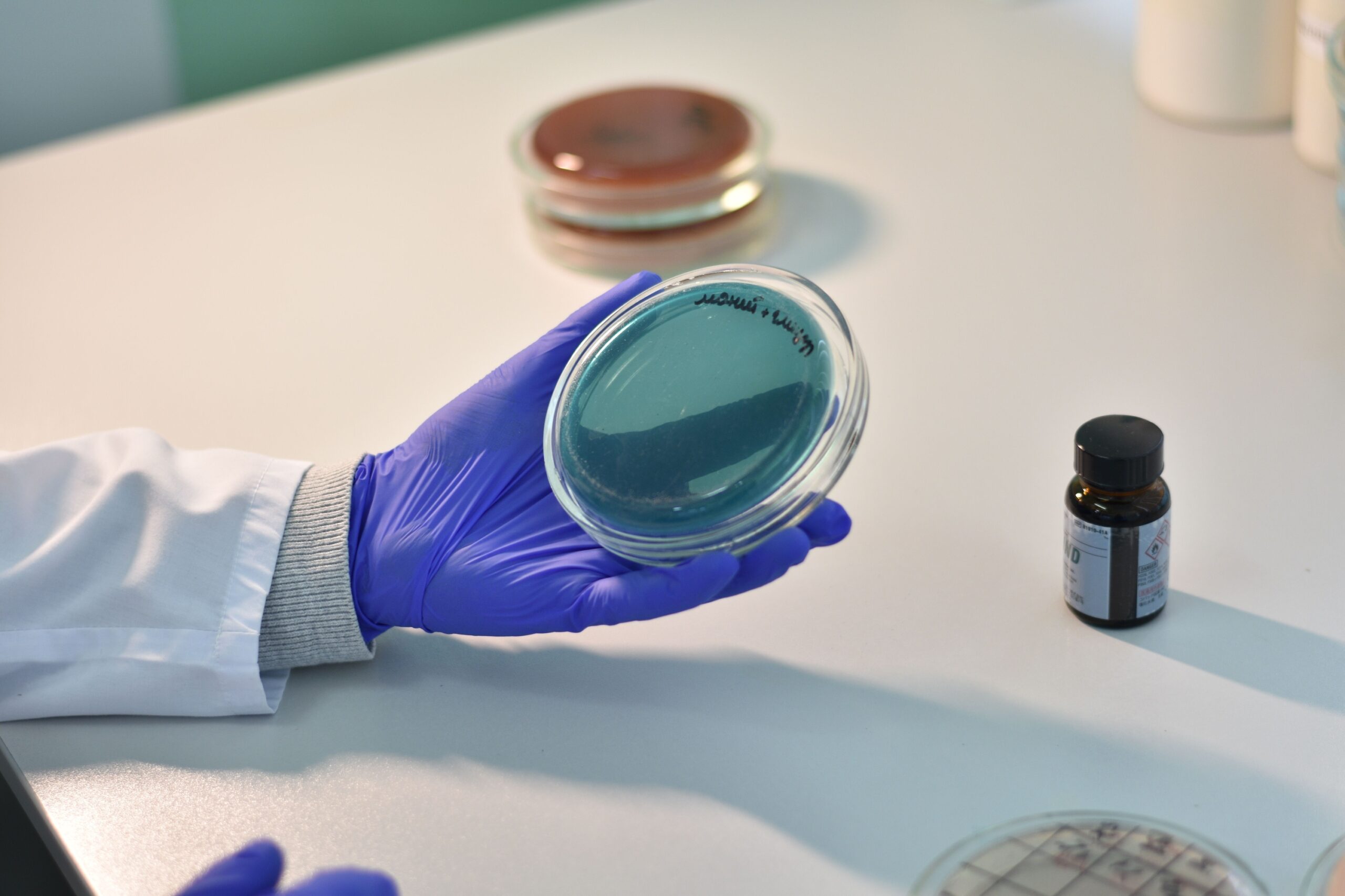4 Foods That Become A Bacterial Breeding Ground If Not Stored Properly