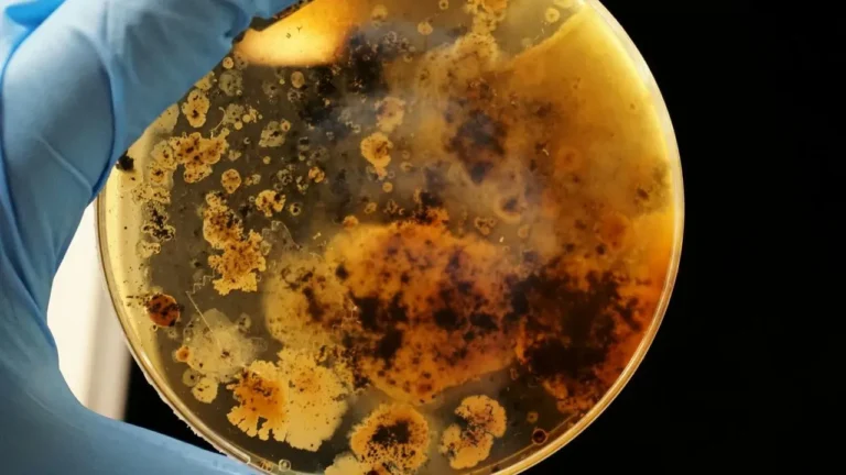 Flesh-Eating Bacteria: Spotting the Warning Signs Before Time Runs Out - Featured image