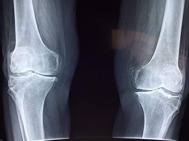5 Foods That Naturally Strengthen Aging Bones - Featured image