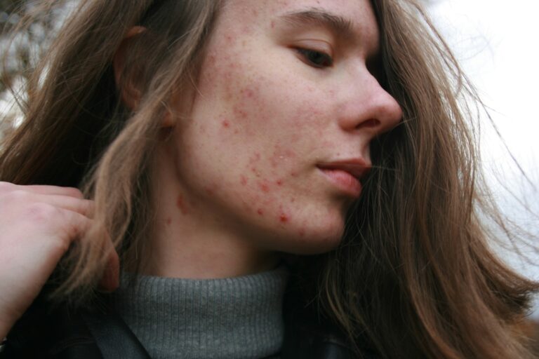 6 Plants That Look Harmless But Cause Painful Skin Reactions - Featured image