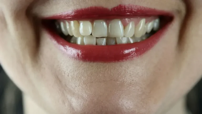 Mouth Microbiome Is the Next Big Wellness Trend as Mouthwash May Do More Harm Than Good - Featured image