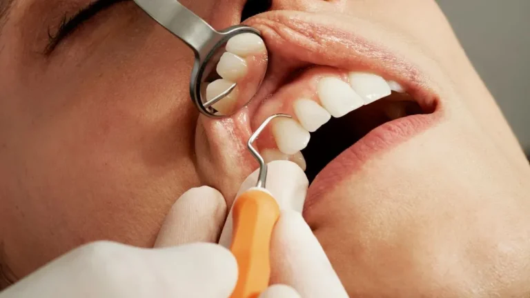 Omega-3 and Aspirin Show Comparable Results to Antibiotics in Periodontitis Trial - Featured image