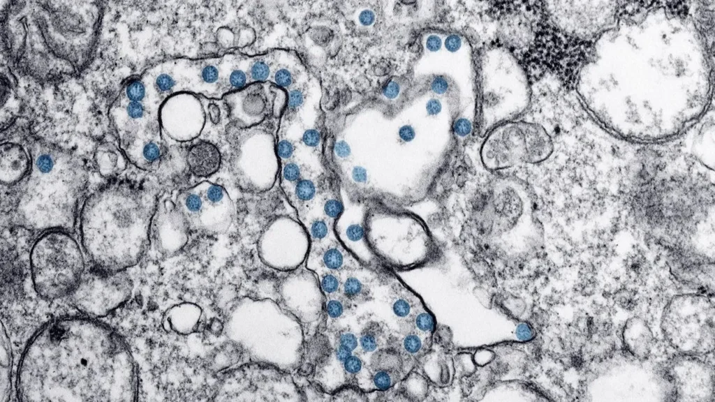 Cyclospora Outbreak Is Officially Over — But Investigators Still Can’t Explain How It Started - Featured image