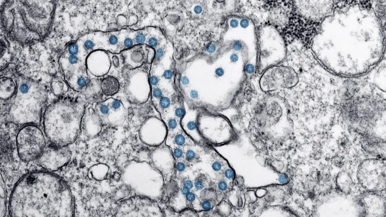 Cyclospora Outbreak Is Officially Over — But Investigators Still Can’t Explain How It Started - Featured image