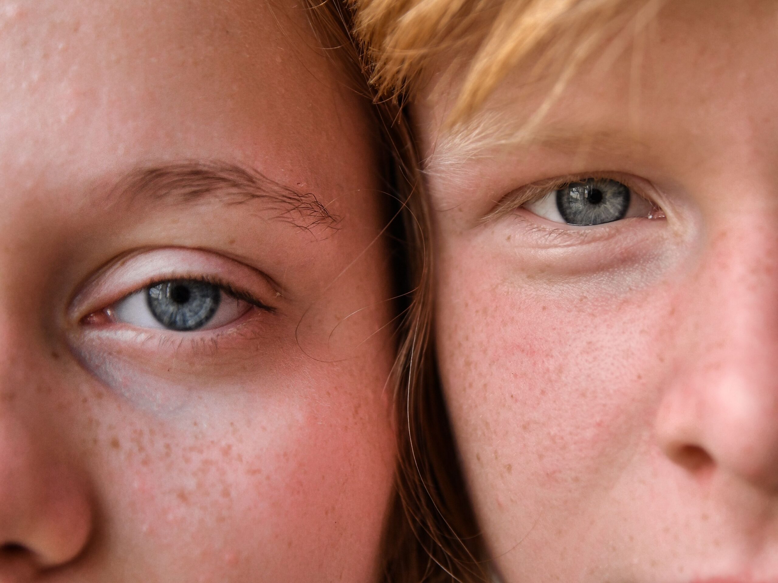 The Sunscreen Spot Dermatologists Say Almost Everyone Misses
